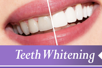 Dental Bonding Can Repair the Look of Teeth - Denville Dental